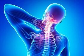 bolovi u leđima kao simptom osteohondroze