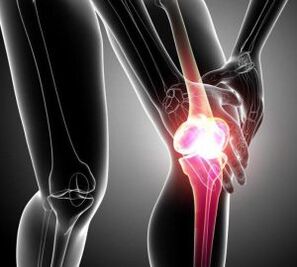 bolovi u koljenu kod artritisa i artroze