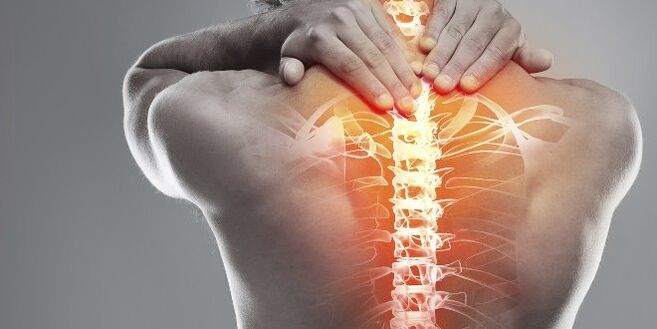 Medicinske mogućnosti za cervikalnu terapiju cervikalne osteohondroze