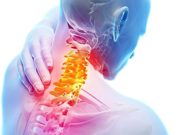 Simptomi i fazi razvoja cervikalne osteohondroze