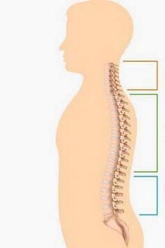 Lezija osteohondroze različitih dijelova kralježnice